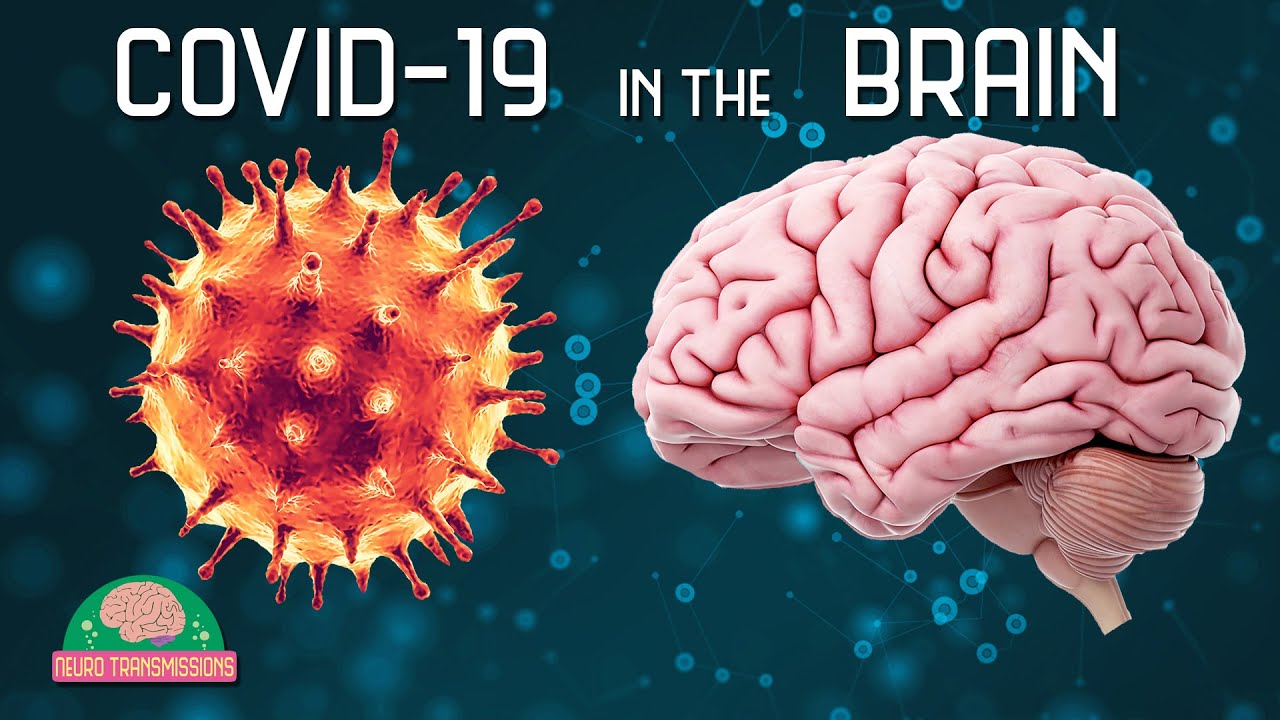 Bad News: One-third of COVID-19 Cured Patients Have Brain Disease